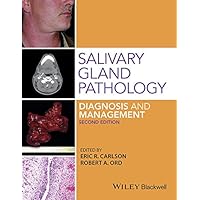 Salivary Gland Pathology: Diagnosis and Management Salivary Gland Pathology: Diagnosis and Management Kindle Hardcover