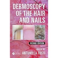 Dermoscopy of the Hair and Nails Dermoscopy of the Hair and Nails Hardcover Kindle