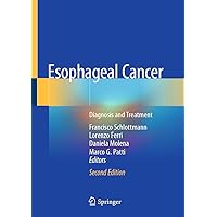 Esophageal Cancer: Diagnosis and Treatment Esophageal Cancer: Diagnosis and Treatment Kindle Hardcover