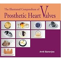 The Illustrated Compendium of Prosthetic Heart Valves The Illustrated Compendium of Prosthetic Heart Valves Hardcover