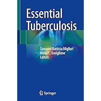 Essential Tuberculosis Essential Tuberculosis Kindle Paperback