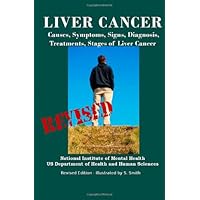 Liver Cancer: Causes, Symptoms, Signs, Diagnosis, Treatments, Stages of Liver Cancer - Revised Edition - Illustrated by S. Smith Liver Cancer: Causes, Symptoms, Signs, Diagnosis, Treatments, Stages of Liver Cancer - Revised Edition - Illustrated by S. Smith Paperback