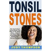 Tonsil Stones: The Truth About Tonsil Stones And What To Do About Them ... Even If You Have Tried Everything And Nothing Has Worked Before!