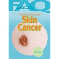 Frequently Asked Questions About Skin Cancer (FAQ: Teen Life, 3) Frequently Asked Questions About Skin Cancer (FAQ: Teen Life, 3) Library Binding
