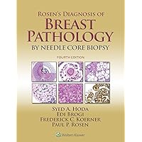 Rosen's Diagnosis of Breast Pathology by Needle Core Biopsy Rosen's Diagnosis of Breast Pathology by Needle Core Biopsy Kindle Hardcover