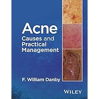 Acne: Causes and Practical Management Acne: Causes and Practical Management Kindle Hardcover