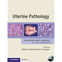 Uterine Pathology (Cambridge Illustrated Surgical Pathology) Uterine Pathology (Cambridge Illustrated Surgical Pathology) Kindle Hardcover