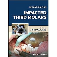 Impacted Third Molars Impacted Third Molars Kindle Hardcover