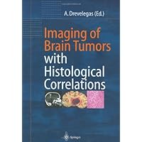 Imaging of Brain Tumors with Histological Correlations Imaging of Brain Tumors with Histological Correlations Kindle Hardcover
