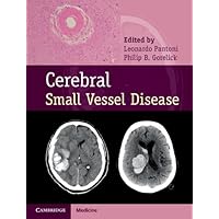 Cerebral Small Vessel Disease Cerebral Small Vessel Disease Kindle Hardcover