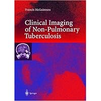 Clinical Imaging in Non-Pulmonary Tuberculosis Clinical Imaging in Non-Pulmonary Tuberculosis Kindle Hardcover