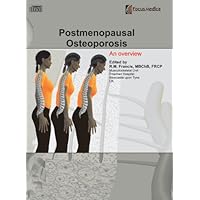 Postmenopausal Osteoporosis: An Overview (Orthopaedics)