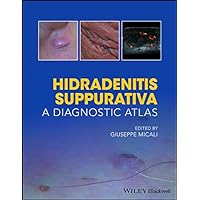 Hidradenitis Suppurativa: A Diagnostic Atlas Hidradenitis Suppurativa: A Diagnostic Atlas Kindle Paperback