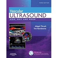 Vascular Ultrasound: How, Why and When Vascular Ultrasound: How, Why and When eTextbook Hardcover