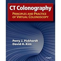 CT Colonography: Principles and Practice of Virtual Colonoscopy CT Colonography: Principles and Practice of Virtual Colonoscopy Kindle Hardcover