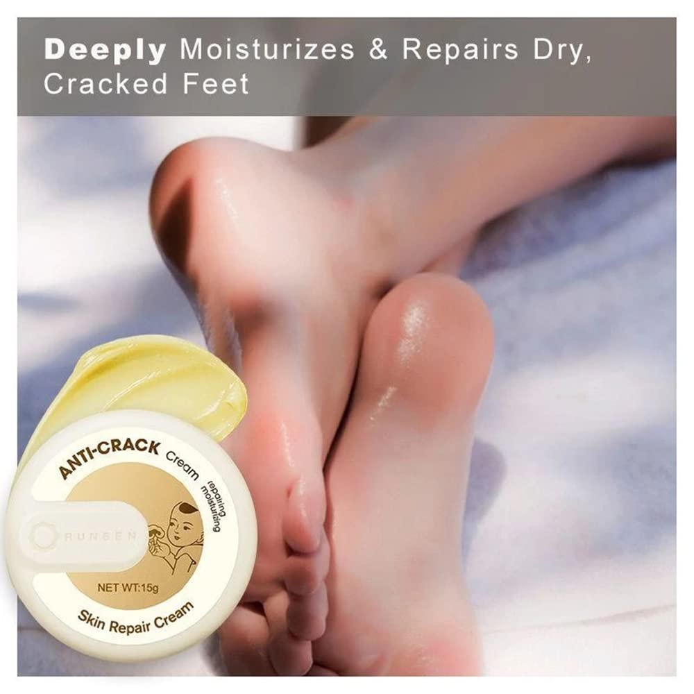 SURORAIN Foot Repair Cream,Moisturizing Foot Cream For Dry Cracked Heels Callus Remover Hand Cream Foot Cream Advanced Repair Cream Body Moisturizer for Very Dry Skin 0.53 Ounce