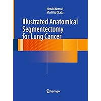 Illustrated Anatomical Segmentectomy for Lung Cancer Illustrated Anatomical Segmentectomy for Lung Cancer Paperback Kindle Hardcover