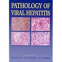 Pathology of Viral Hepatitis Pathology of Viral Hepatitis Hardcover