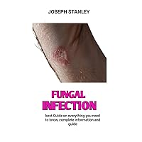 Fungal infection : Laboratory Diagnosis of Fungal Infections Fungal infection : Laboratory Diagnosis of Fungal Infections Kindle Paperback