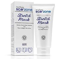 Stretch Mark Cream 200 G.(Thank you kindly by AGB”)