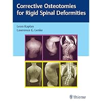 Corrective Osteotomies for Rigid Spinal Deformities Corrective Osteotomies for Rigid Spinal Deformities Kindle Hardcover