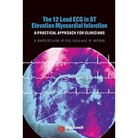 The 12 Lead ECG in ST Elevation Myocardial Infarction: A Practical Approach for Clinicians The 12 Lead ECG in ST Elevation Myocardial Infarction: A Practical Approach for Clinicians Kindle Paperback