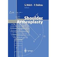 Shoulder Arthroplasty Shoulder Arthroplasty Hardcover Paperback