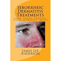 Seborrheic Dermatitis Treatments: Signs, Causes, Triggers, Stress, & Product Images Seborrheic Dermatitis Treatments: Signs, Causes, Triggers, Stress, & Product Images Paperback