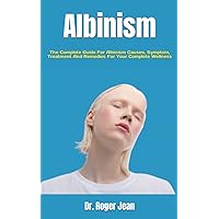Albinism: The Complete Guide For Albinism Causes, Symptom, Treatment And Remedies For Your Complete Wellness Albinism: The Complete Guide For Albinism Causes, Symptom, Treatment And Remedies For Your Complete Wellness Paperback Kindle