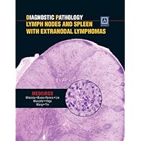 Diagnostic Pathology: Lymph Nodes and Spleen With Extranodal Lymphomas Diagnostic Pathology: Lymph Nodes and Spleen With Extranodal Lymphomas Hardcover
