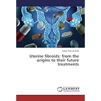Uterine fibroids: from the origins to their future treatments