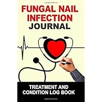 Fungal Nail Infection: Journal Treatment and Condition Log Book Fungal Nail Infection: Journal Treatment and Condition Log Book Paperback