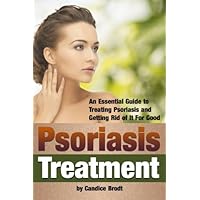 Psoriasis Treatment: An Essential Guide to Treating Psoriasis and Getting Rid of It For Good ( How to Treat Psoriasis or Scalp Psoriasis ) Psoriasis Treatment: An Essential Guide to Treating Psoriasis and Getting Rid of It For Good ( How to Treat Psoriasis or Scalp Psoriasis ) Paperback Kindle
