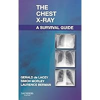 The Chest X-Ray: A Survival Guide The Chest X-Ray: A Survival Guide Paperback Kindle