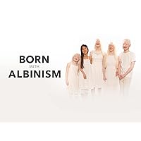 Born With Albinism - Season 1
