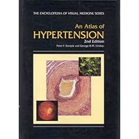 An Atlas of Hypertension, Second Edition (Encyclopedia of Visual Medicine Series) An Atlas of Hypertension, Second Edition (Encyclopedia of Visual Medicine Series) Hardcover