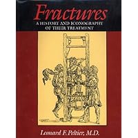 Fractures: A History and Iconography of Their Treatment Fractures: A History and Iconography of Their Treatment Hardcover