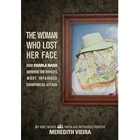 The Woman Who Lost Her Face: How Charla Nash Survived the World's Most Infamous Chimpanzee Attack The Woman Who Lost Her Face: How Charla Nash Survived the World's Most Infamous Chimpanzee Attack Kindle