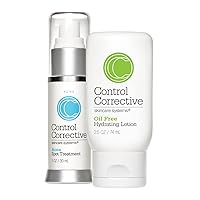 CONTROL CORRECTIVE Acne Spot Treatment and Oil Free Hydrating Lotion Combo, Skin Calming and Clearing