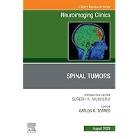 Spinal Tumors, An Issue of Neuroimaging Clinics of North America, E-Book (The Clinics: Radiology) Spinal Tumors, An Issue of Neuroimaging Clinics of North America, E-Book (The Clinics: Radiology) Kindle Hardcover