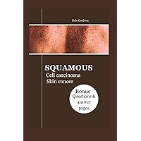 SQUAMOUS CELL CARCINOMA SKIN CANCER: The Illustrated Guide: Types, Diagnosis, Treatment, Prevention, Resources, Management And Question to ask your doctor