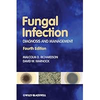Fungal Infection: Diagnosis and Management Fungal Infection: Diagnosis and Management Kindle Paperback
