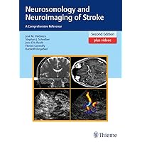 Neurosonology and Neuroimaging of Stroke: A Comprehensive Reference Neurosonology and Neuroimaging of Stroke: A Comprehensive Reference Kindle Plastic Comb