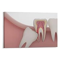 Dental Clinic Poster Wisdom Teeth Growth Danger Oral Health Canvas Painting Modern Wall Decor Wall A Canvas Painting Posters and Prints Wall Art Pictures for Living Room Bedroom Decor 12x08inch(30x20