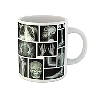 Coffee Mug Anatomy of X Ray Multiple Part Human Skeletal System 11 Oz Ceramic Tea Cup Mugs Souvenir for Family Friends Coworkers