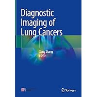 Diagnostic Imaging of Lung Cancers Diagnostic Imaging of Lung Cancers Hardcover Kindle