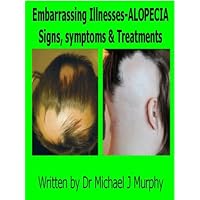 Embarrassing Illnesses - Alopecia - Signs, Symptoms, & Treatments Embarrassing Illnesses - Alopecia - Signs, Symptoms, & Treatments Kindle