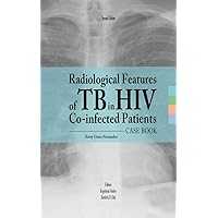 Radiological Features of TB in HIV Co-infected Patients. Case Book Radiological Features of TB in HIV Co-infected Patients. Case Book Kindle Paperback