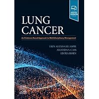 Lung Cancer: An Evidence-Based Approach to Multidisciplinary Management Lung Cancer: An Evidence-Based Approach to Multidisciplinary Management Hardcover Kindle