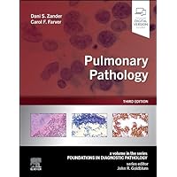 Pulmonary Pathology (Foundations in Diagnostic Pathology) Pulmonary Pathology (Foundations in Diagnostic Pathology) Hardcover Kindle